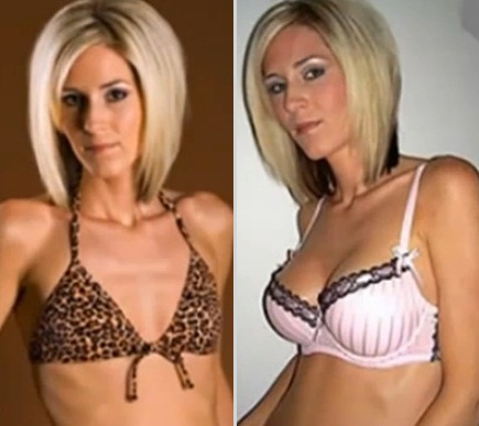 Julie a augmenté la taille de sa poitrine et de son bonnet