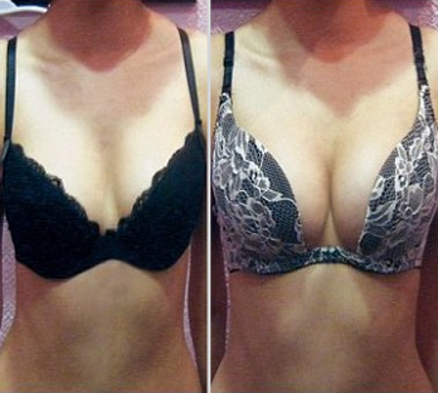 Témoignage anonyme pour grossir les seins naturellement